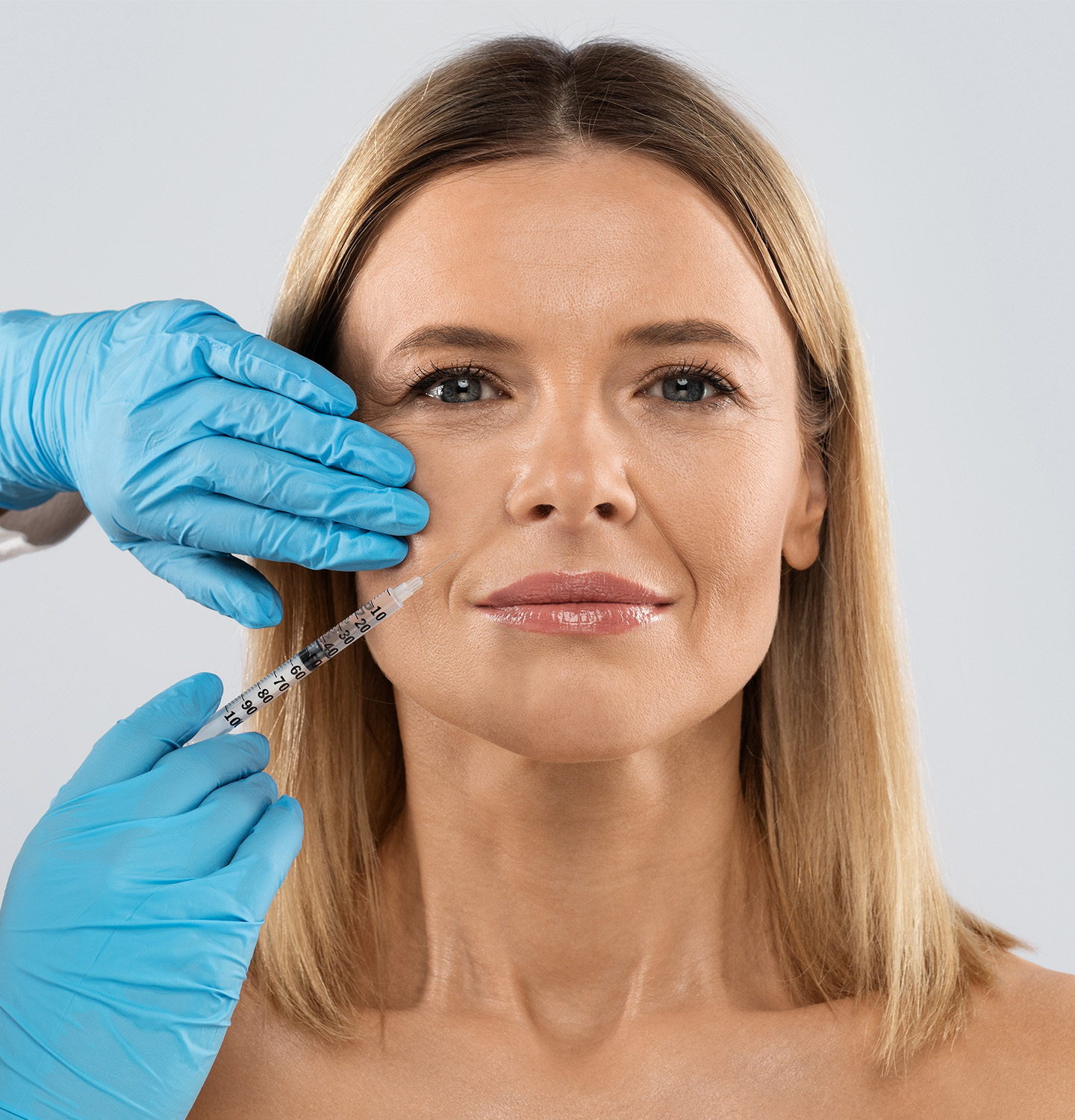 Hyaluronic Acid Dermal Fillers
